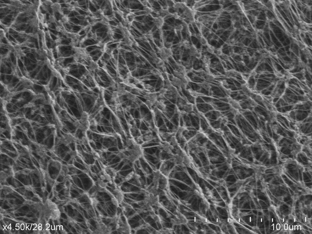 This is a scanning electron microscope image of ePTFE. It shows a fibrous structure.
