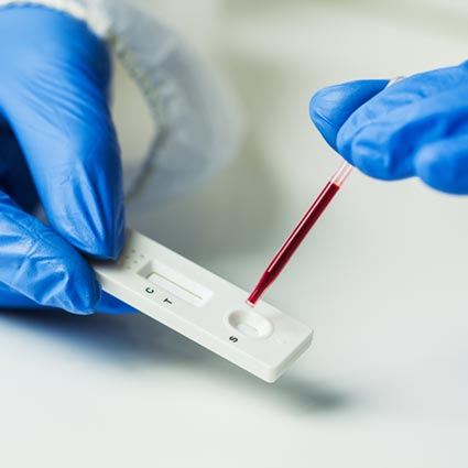 This is an image of a lateral flow assay being used for a blood test. 